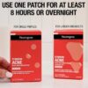 Neutrogena Stubborn Acne Spot Patches2 Neutrogena Stubborn Acne Spot Patches (24 pcs)