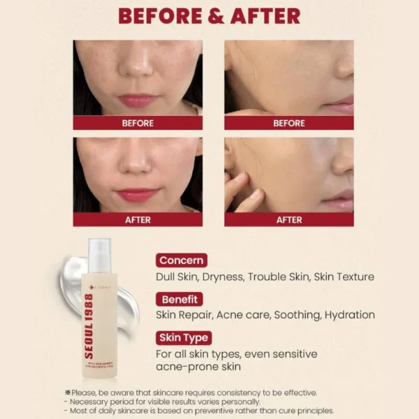 k secret seoul 1988 essence 3 K-SECRET Seoul 1988 Essence: Snail Mucin 97% + Rice 100ml